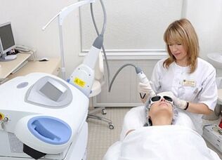 výhody a nevýhody frakčního omlazení pokožky obličeje pomocí laseru